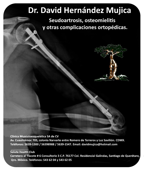 Recuperación exitosa de la extremidad mediante un abordaje ortoplástico de lesiones abiertas del hombro tipo IIIB: informe de 3 casos